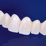 Răng sứ Zirconia giá bao nhiêu?