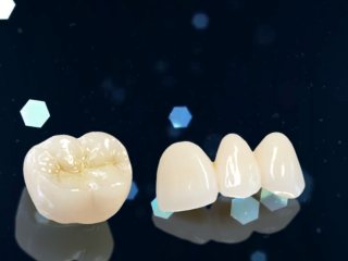 Răng sứ Ceramill Zolid 