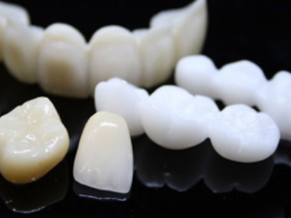 PHỤC HÌNH RĂNG XỨ DDBIO