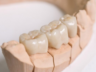PHỤC HÌNH RĂNG SỨ ZIRCONIA HT 